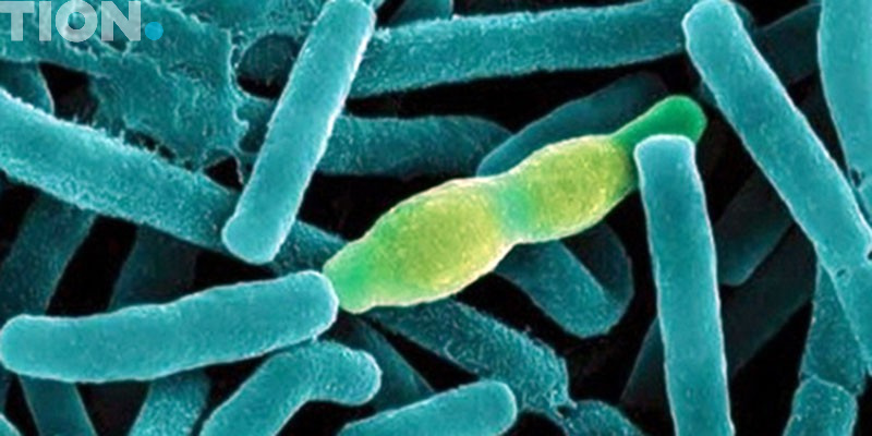 Сибирская язва