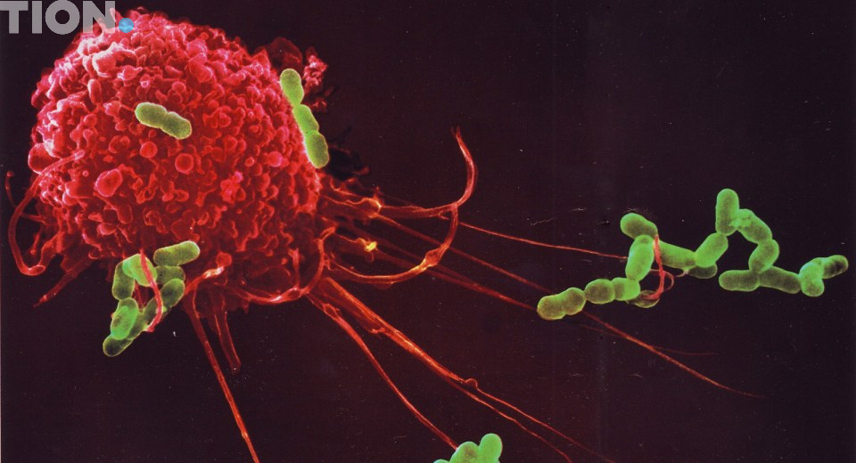 воспаление в легких