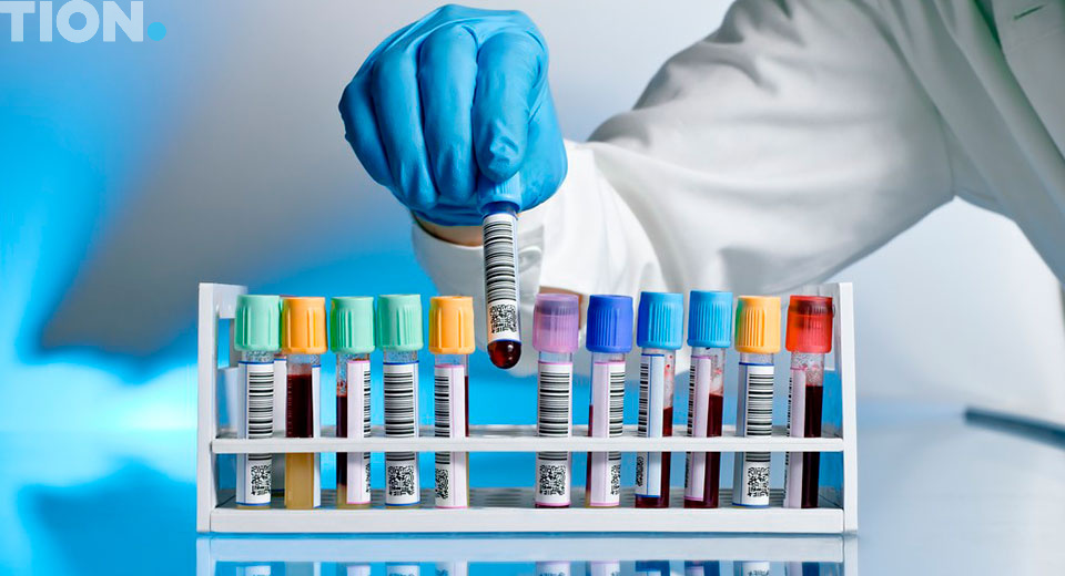 Лабораторный тест крови на аллергию