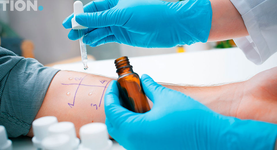 Кожные аллергические пробы